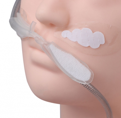 nasal high flow therapy